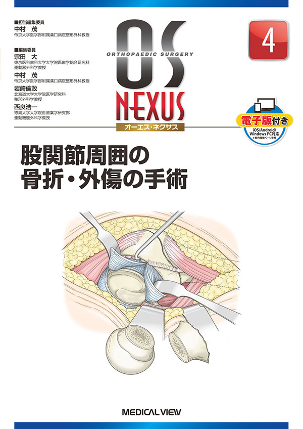 股関節周囲の骨折・外傷の手術