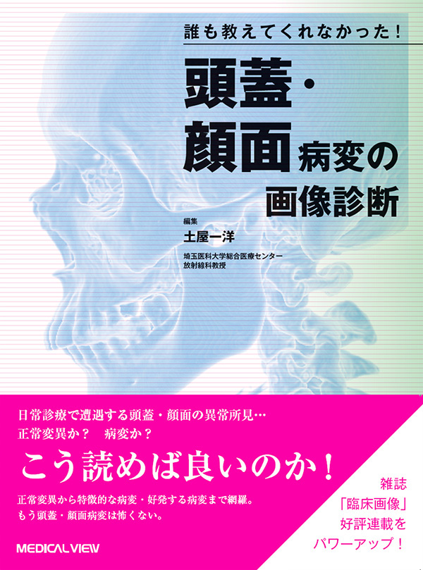 頭蓋・顔面病変の画像診断