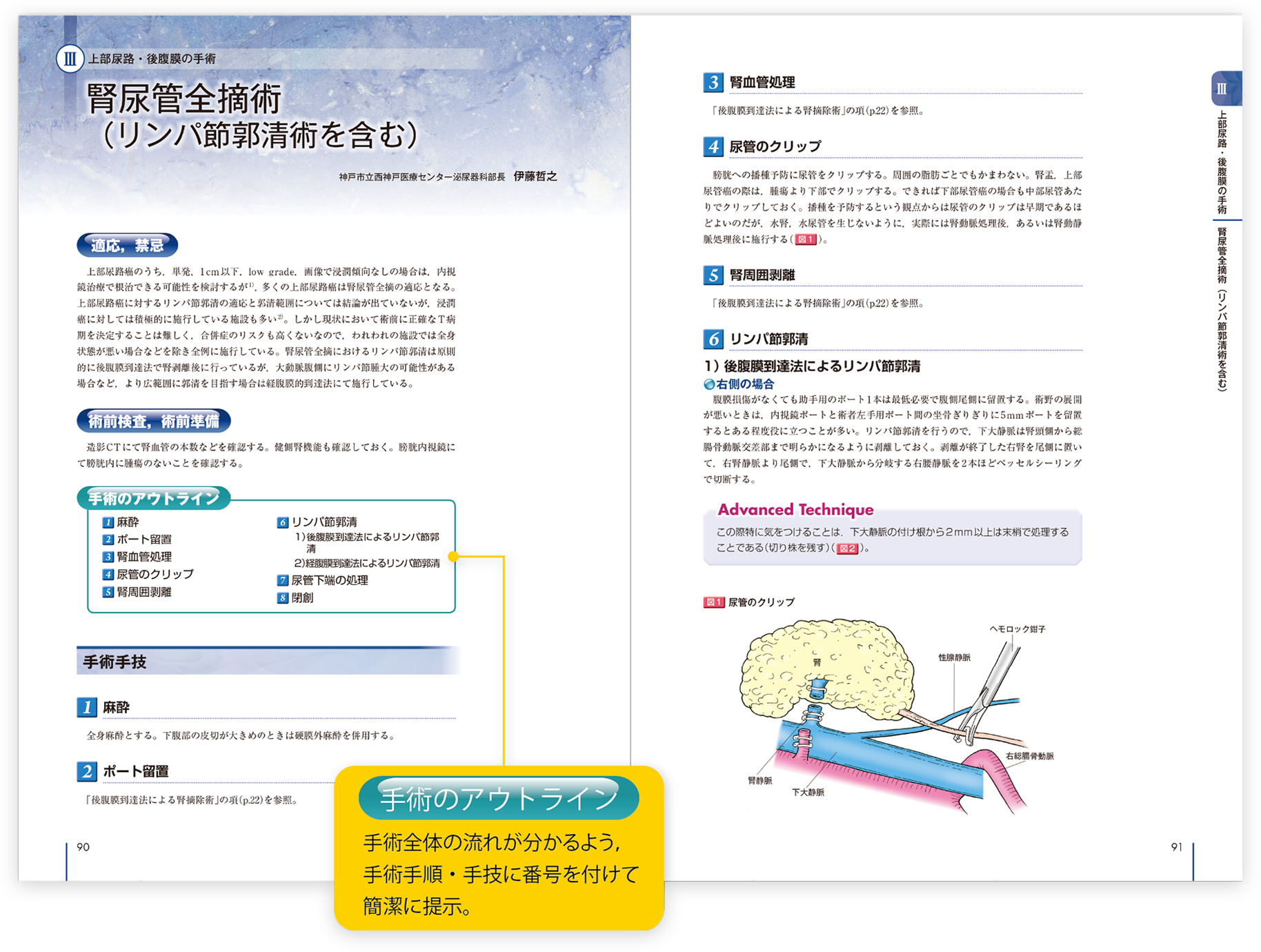 メジカルビュー社 | Urologic Surgery Next