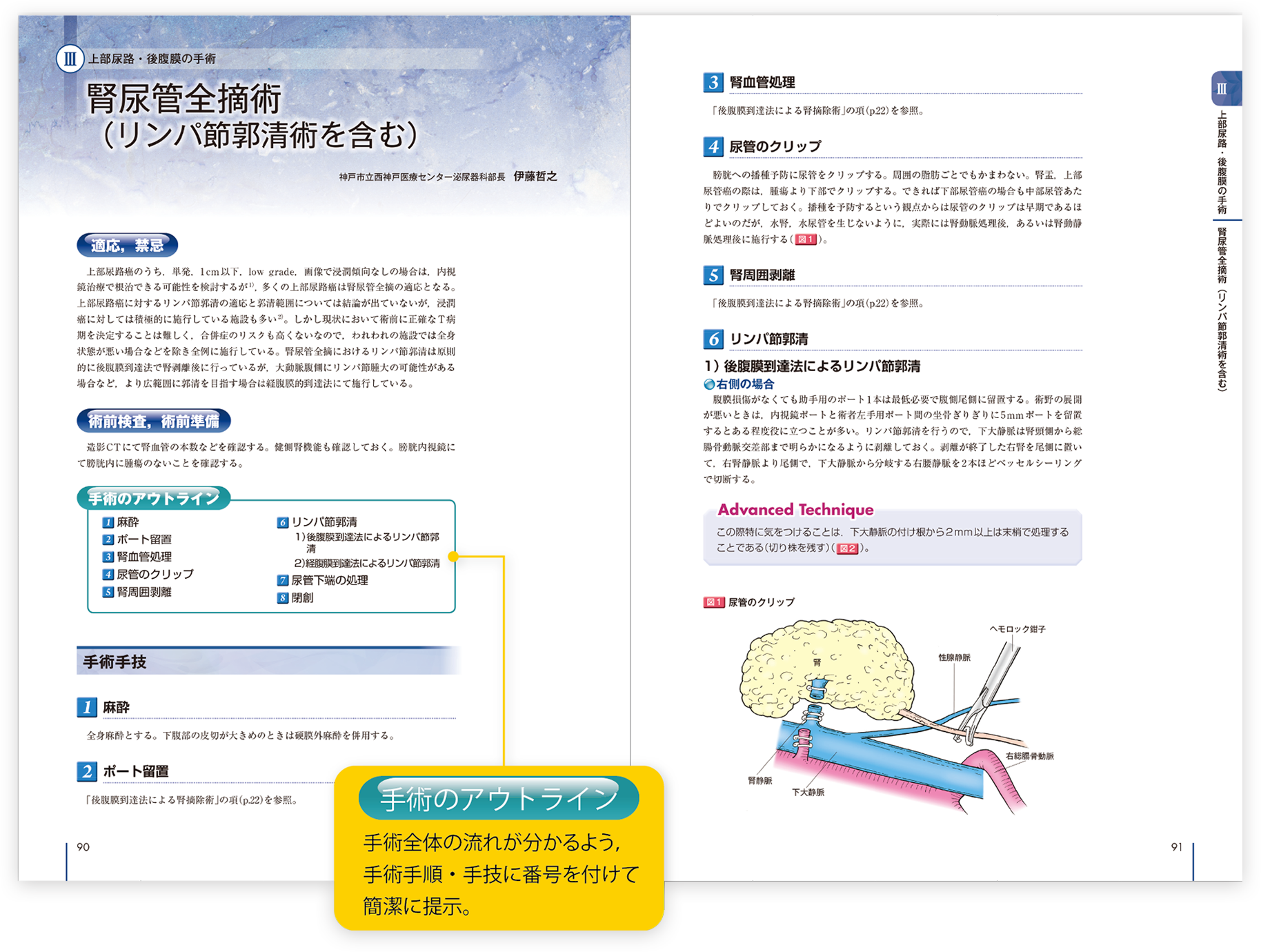 Urologic Surgery Next オープンサージャリー