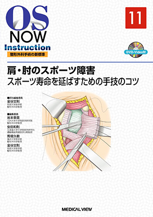 メジカルビュー社｜整形外科｜肘関節手術のすべて