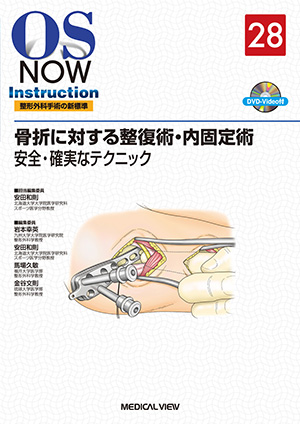 メジカルビュー社｜整形外科｜OS NEXUS（電子版付き） 3 手・手関節の 