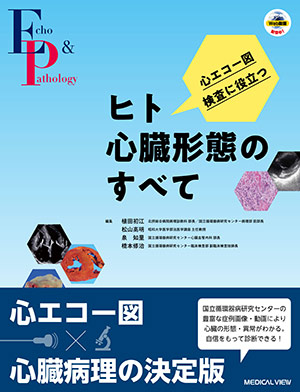 メジカルビュー社｜画像医学・放射線医学｜心不全治療に心エコーを ...