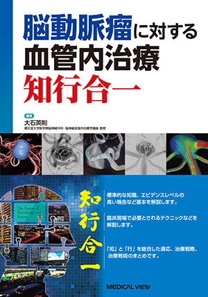 メジカルビュー社｜脳神経外科｜パーフェクトマスター脳血管内治療