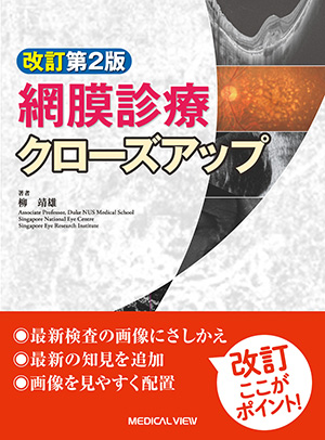 メジカルビュー社｜眼科｜小切開硝子体手術 入門!