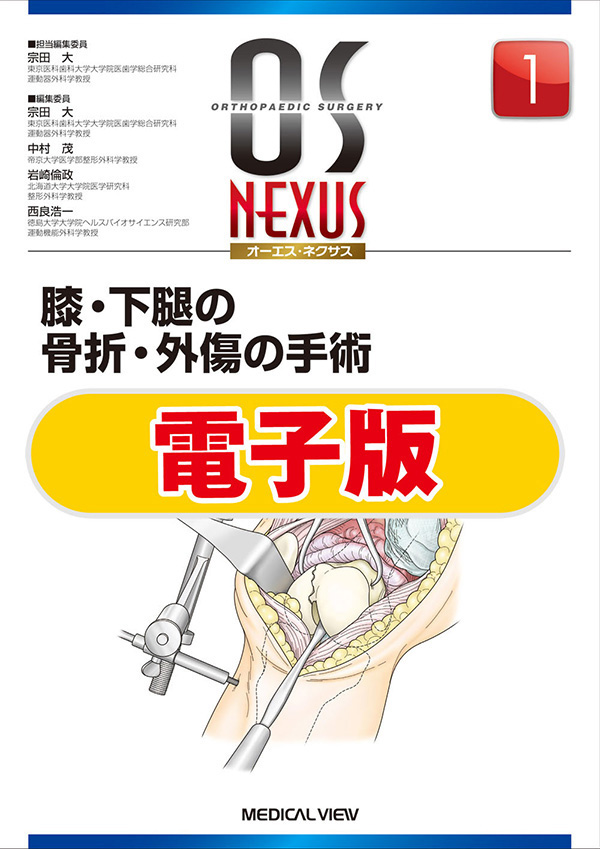 膝・下腿の骨折・外傷の手術【電子版】
