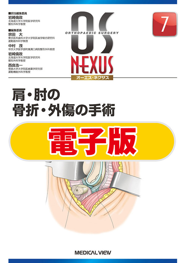 肩・肘の骨折・外傷の手術【電子版】
