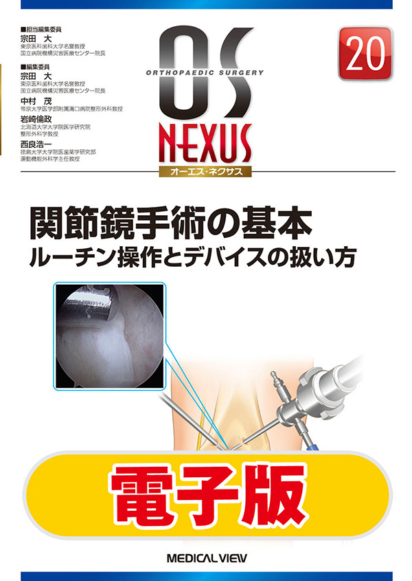 関節鏡手術の基本【電子版】
