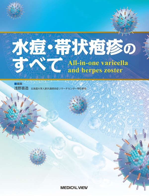 水痘・帯状疱疹のすべて