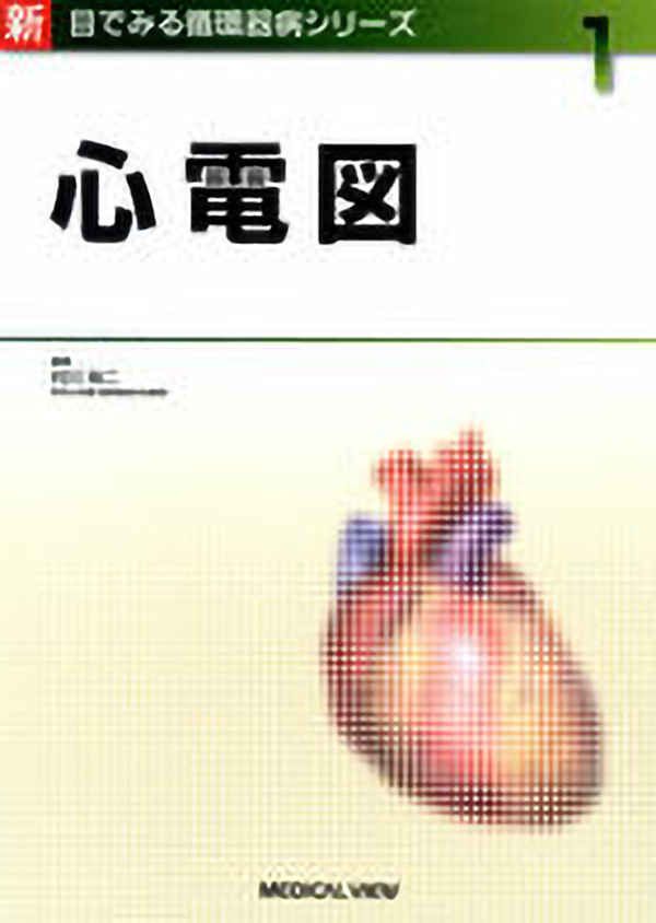 心電図