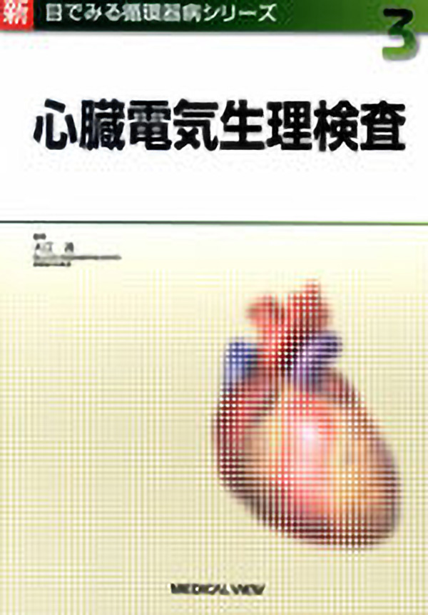 心臓電気生理検査