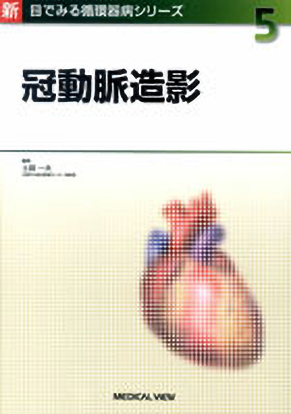 冠動脈造影