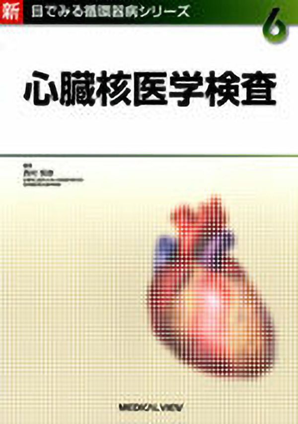 心臓核医学検査