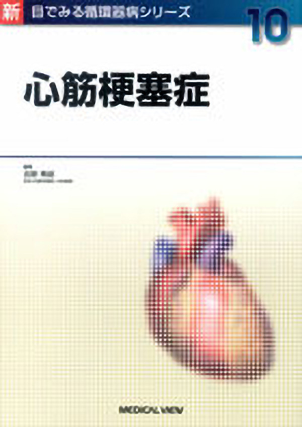 心筋梗塞症
