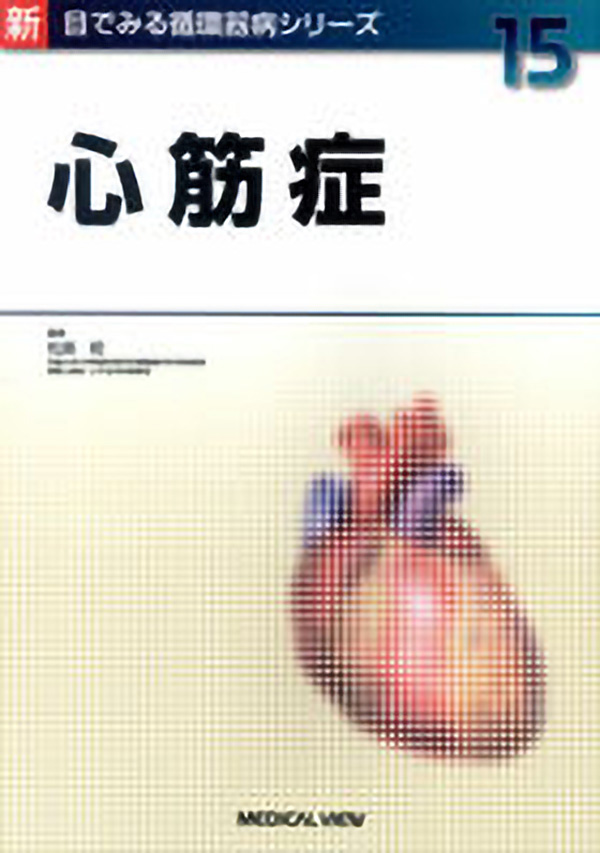 心筋症