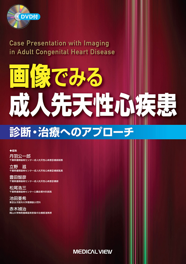 画像でみる成人先天性心疾患