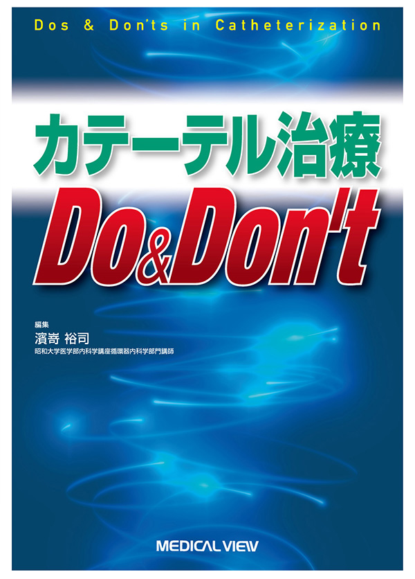 カテーテル治療Do&Don't