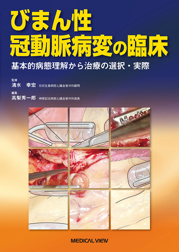 びまん性冠動脈病変の臨床