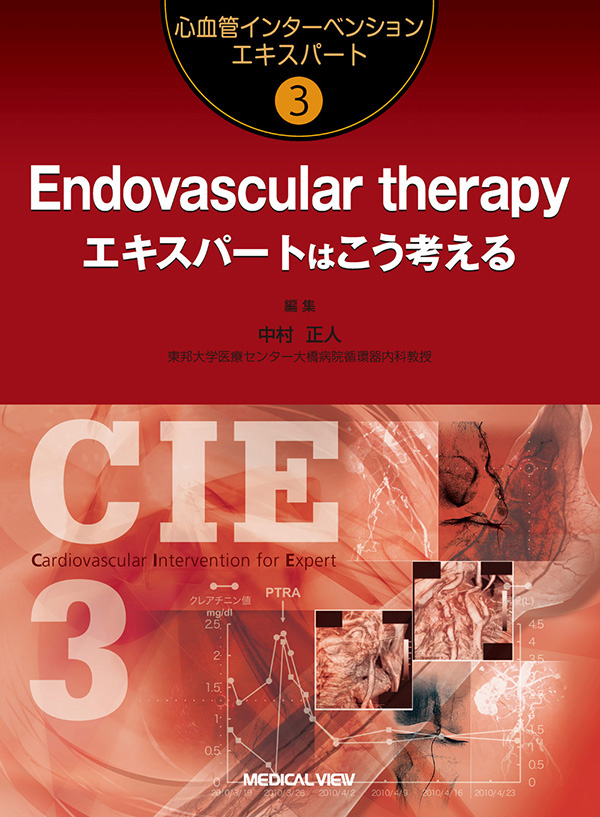 Endovascular therapy