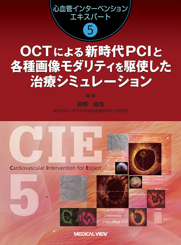 OCTによる新時代PCIと各種画像モダリティを駆使した治療シミュレーション