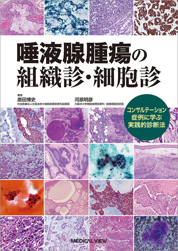 唾液腺腫瘍の組織診・細胞診