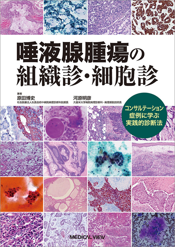 唾液腺腫瘍の組織診・細胞診