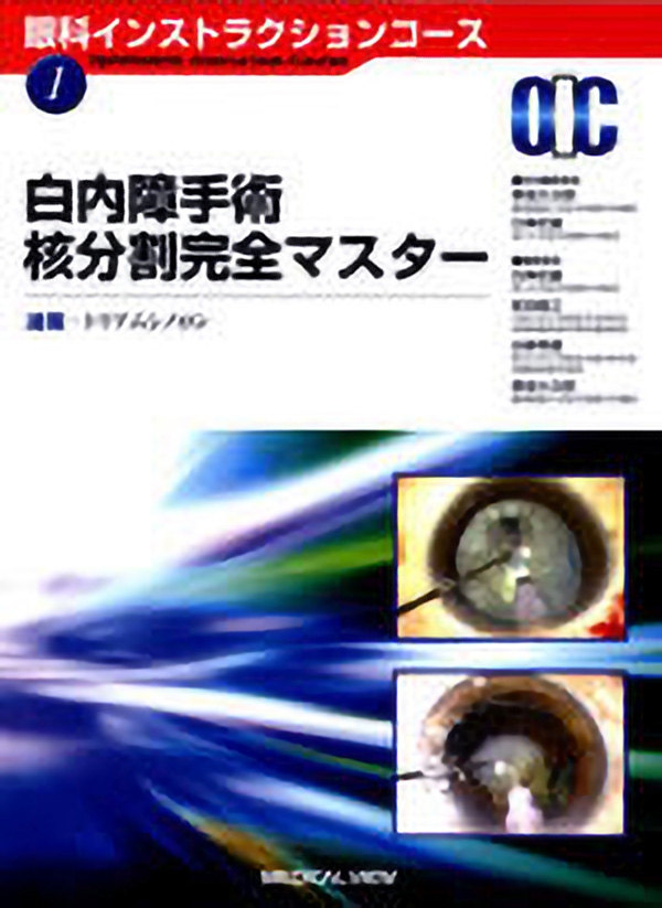 白内障手術 核分割完全マスター