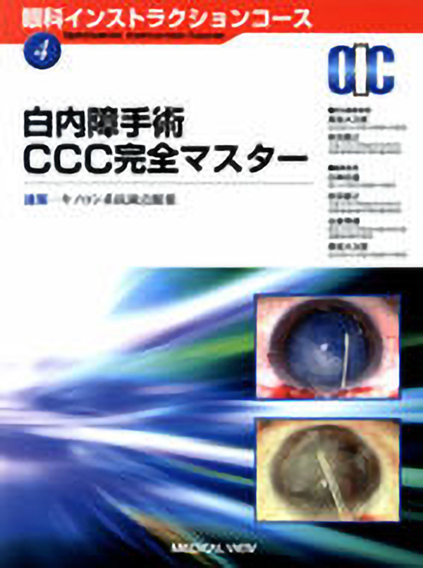 白内障手術CCC 完全マスター