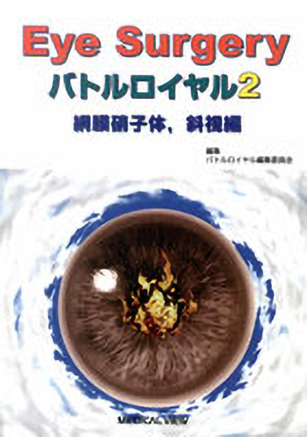網膜硝子体,斜視編