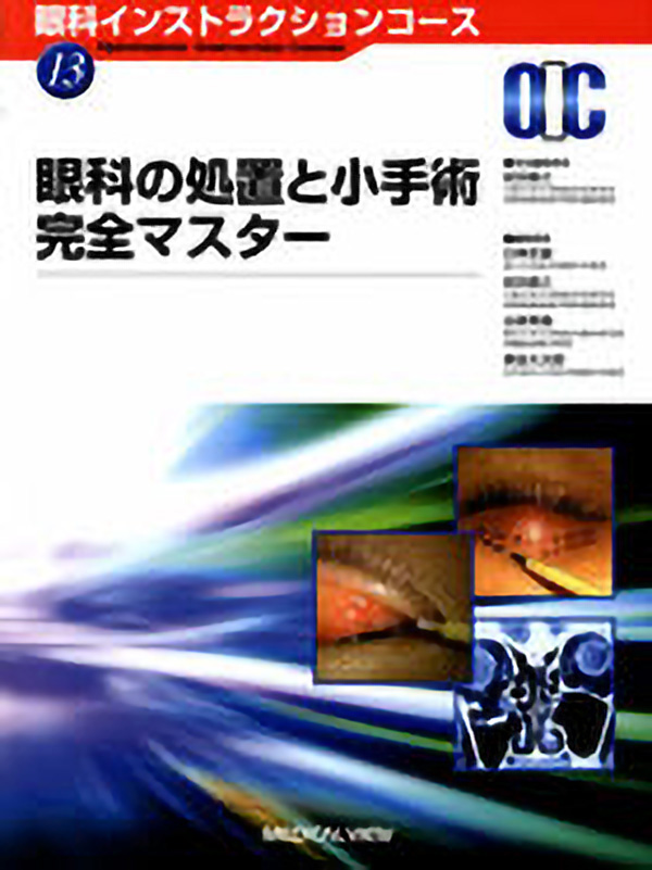 眼科の処置と小手術 完全マスター
