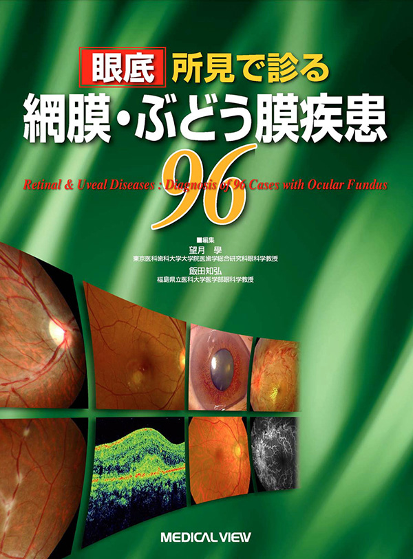 眼底所見で診る 網膜・ぶどう膜疾患96