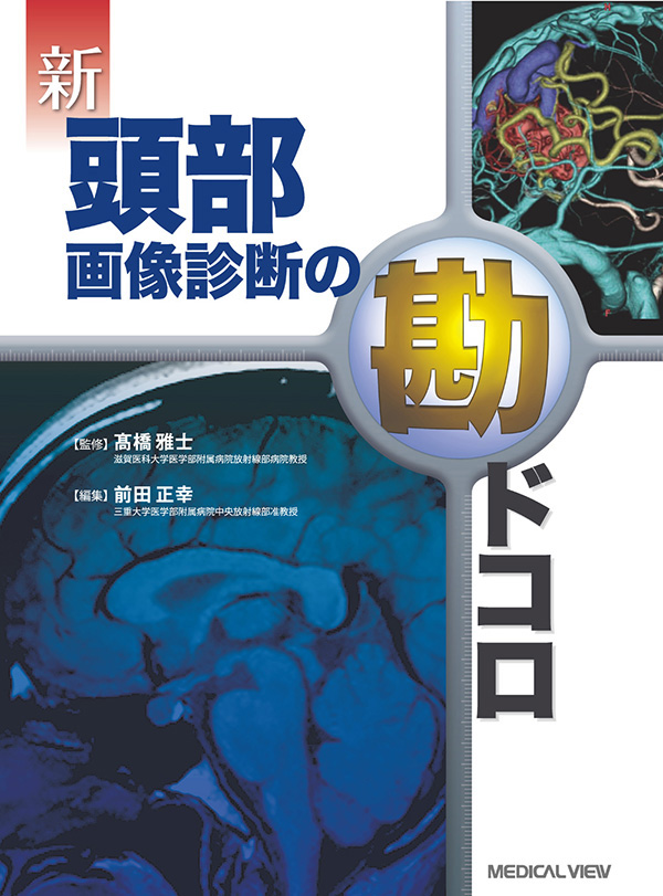 新 頭部画像診断の勘ドコロ