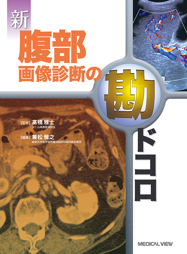 新 腹部画像診断の勘ドコロ
