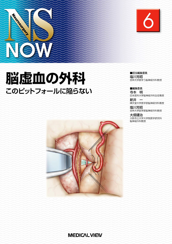 脳虚血の外科