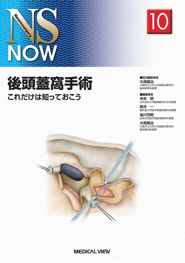 後頭蓋窩手術