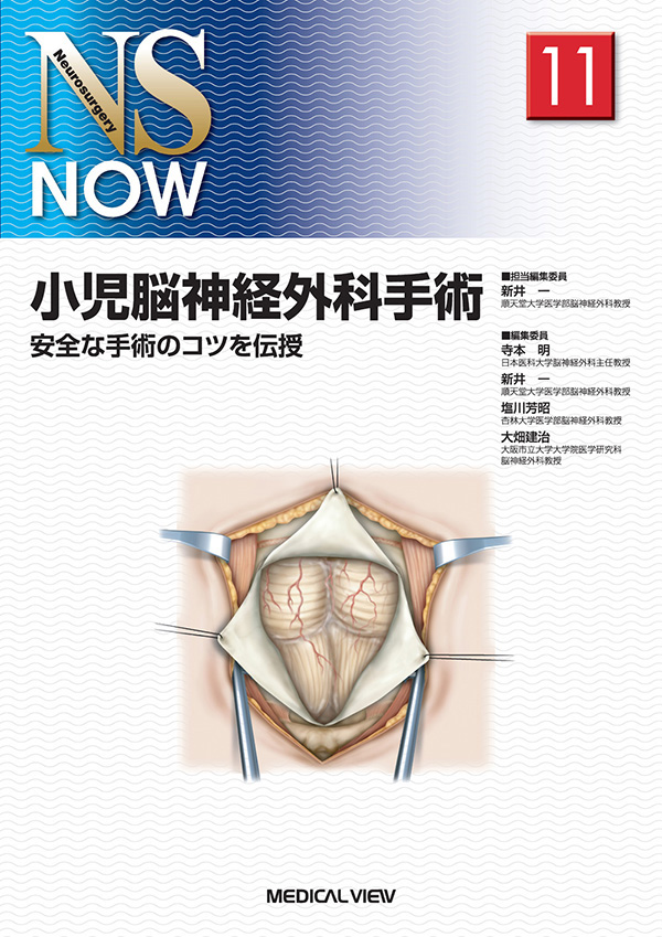 小児脳神経外科手術