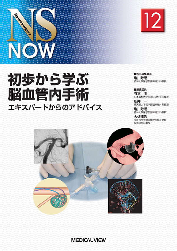 初歩から学ぶ脳血管内手術