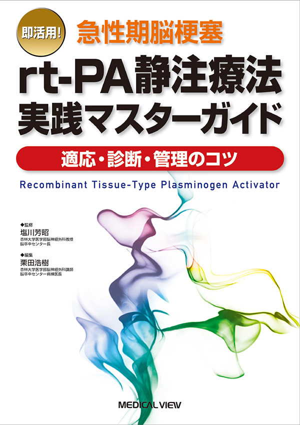 急性期脳梗塞rt-PA静注療法実践マスターガイド