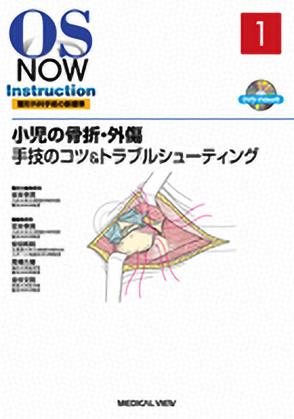 小児の骨折・外傷