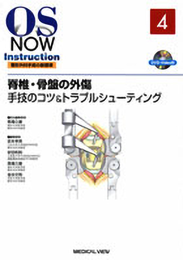 脊椎・骨盤の外傷