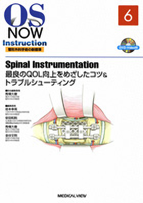 メジカルビュー社 整形外科 Os Now Instruction No 6 Spinal Instrumentation メジカルビュー社 整形外科 Os Now Instruction No 6 Spinal Instrumentation