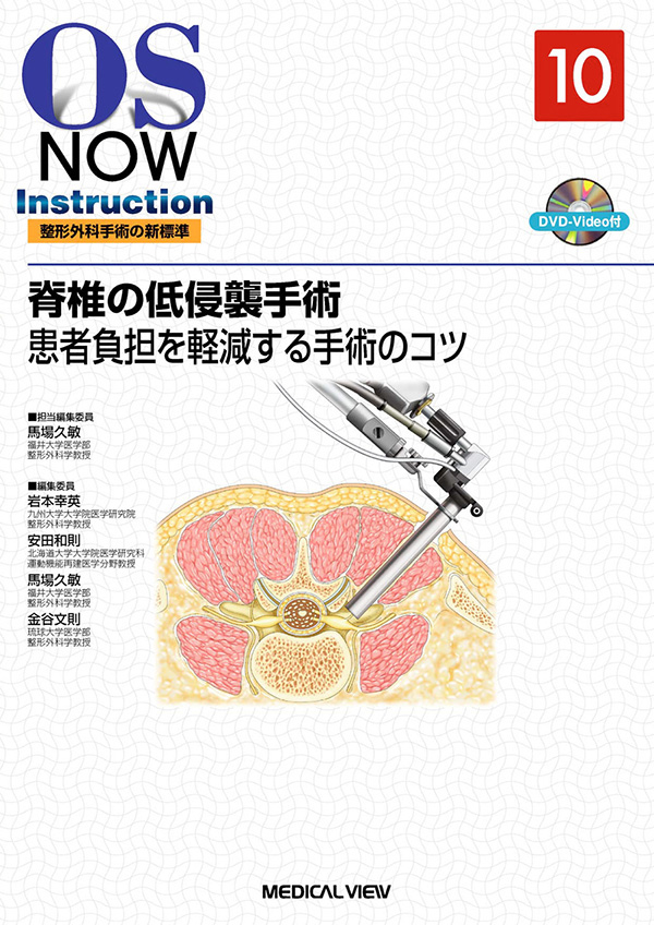 脊椎の低侵襲手術