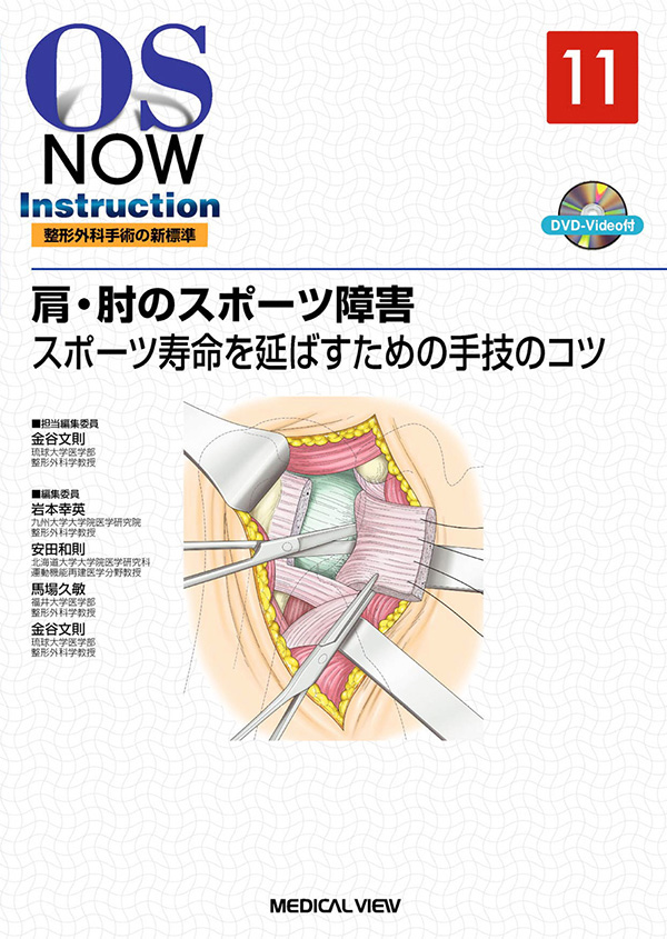 肩・肘のスポーツ障害