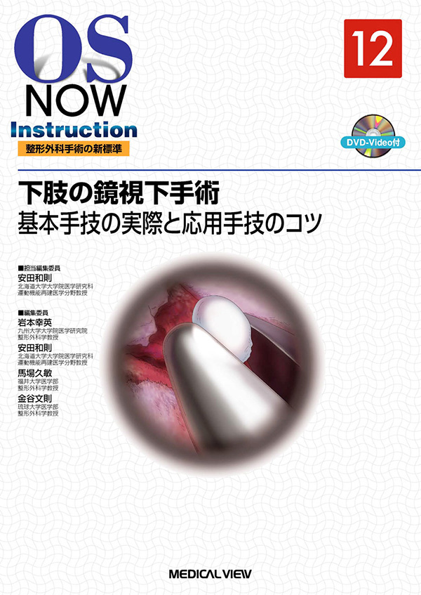 下肢の鏡視下手術