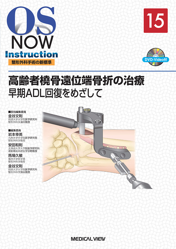 高齢者橈骨遠位端骨折の治療