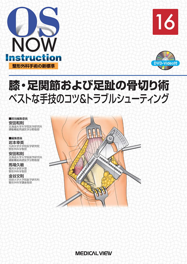 膝・足関節および足趾の骨切り術