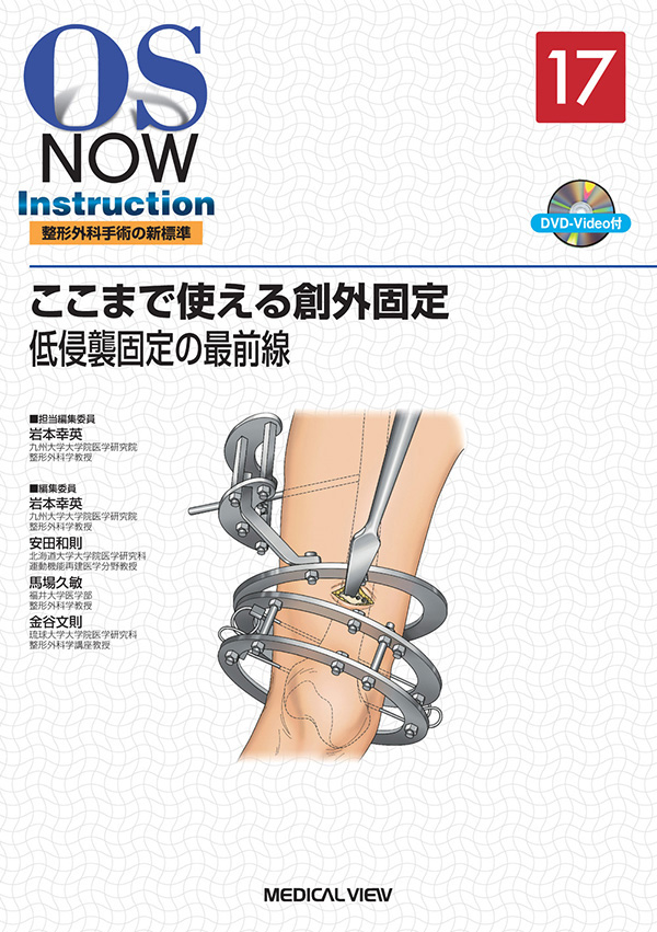 ここまで使える創外固定