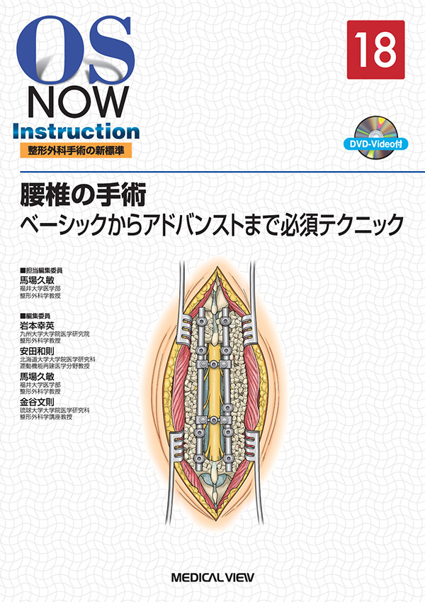 腰椎の手術