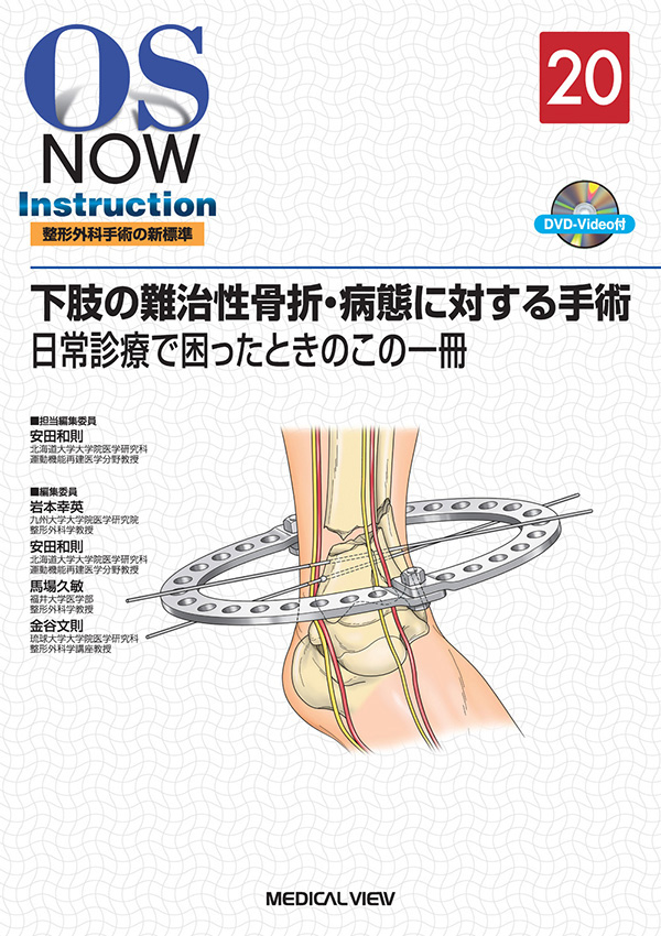 下肢の難治性骨折・病態に対する手術