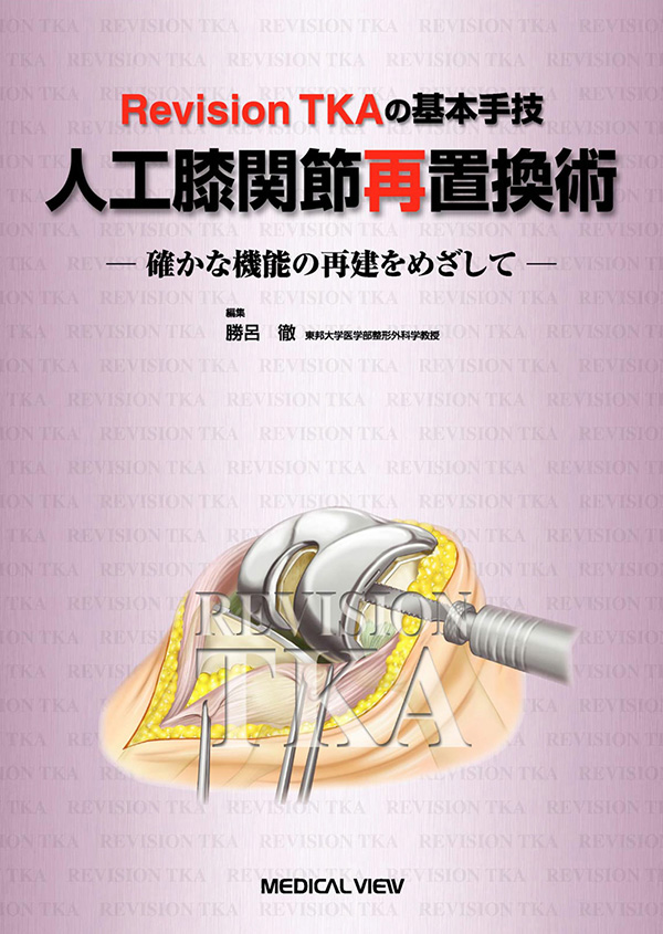 人工膝関節再置換術